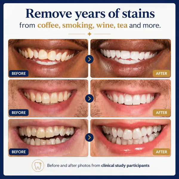 Teeth Whitening Pen